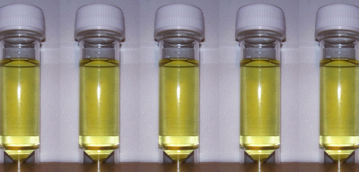 Versatile Stem Cells Found in Urine