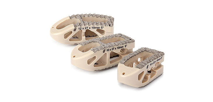 Ti-Bond PEEK 5X Stronger Than Naked PEEK
