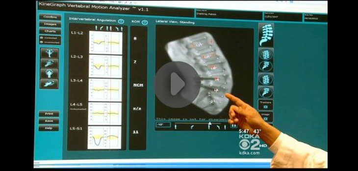 Ortho Kinematics System Cleared for Cervical