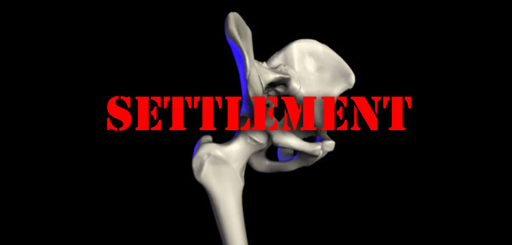 $3 Billion ASR Hip Settlement Rumored