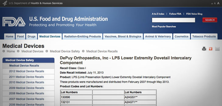DePuy Recalls Femur Component