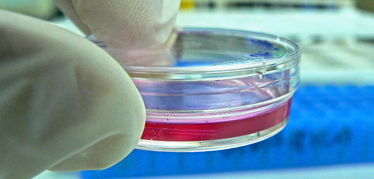 3-D Printer Plus Stem Cells Equals Cartilage