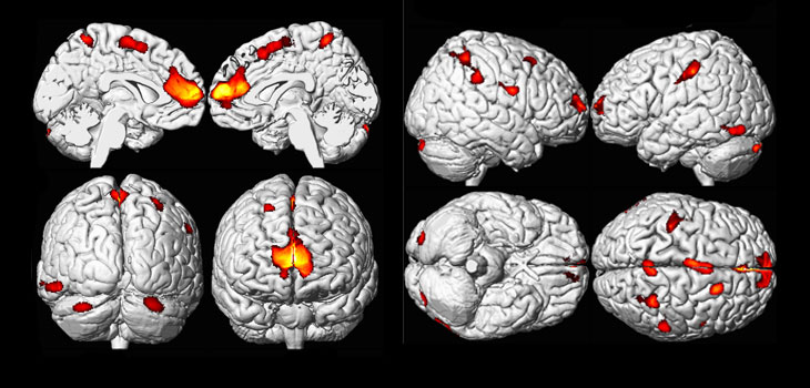 Stem Cells Assemble Early Stage Human Brain