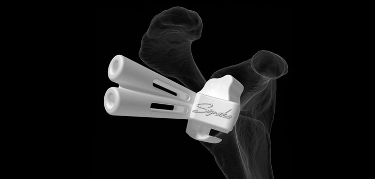 Biomet Claims First with Shoulder System