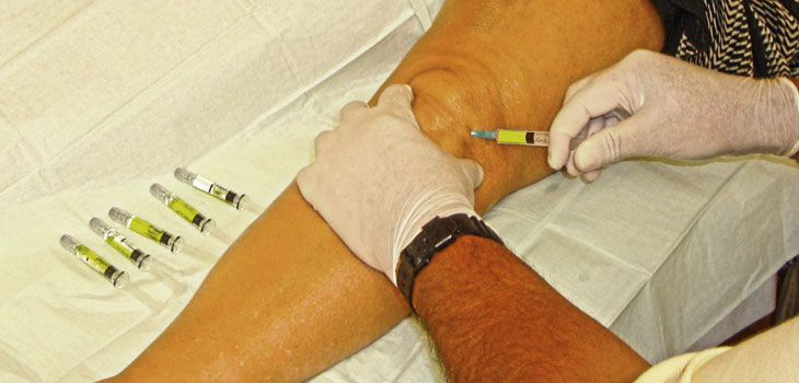 HA Injections Ease Knee Osteoarthritis Pain