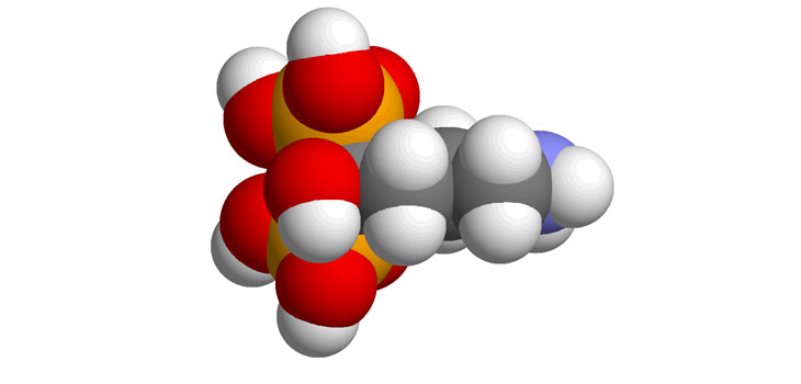 Osteoporosis Drug Helps Hip, Knee OA