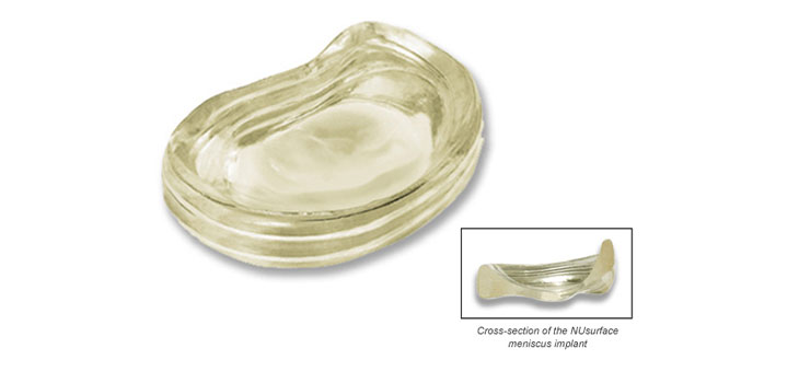 Active Implants Secures Funding for Trial