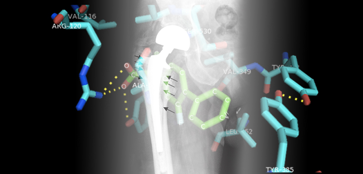 Study: Patient Satisfaction NOT Proxy for Quality // Gene Expression and Hip Wear // and More!