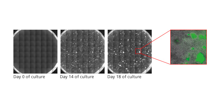 Researchers Make Cartilage From Skin Cells