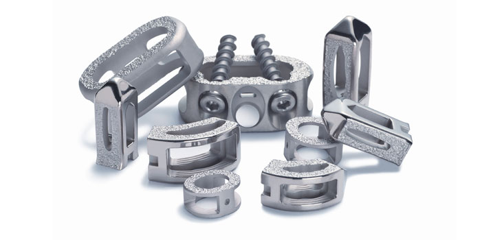 Titan Spine’s Rough Technology Reaches Smooth Milestones