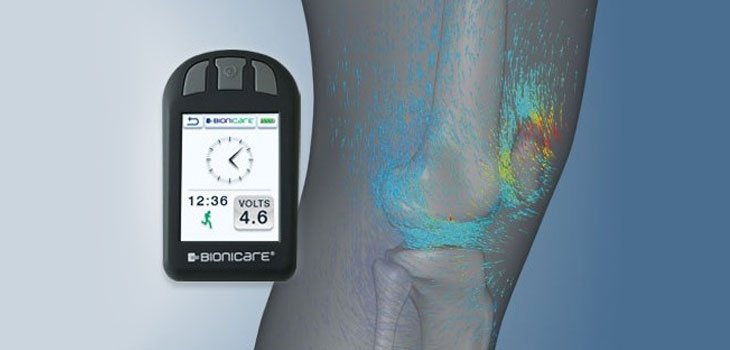 Stimulation Plus Brace Boosts Clinical Knee Outcomes