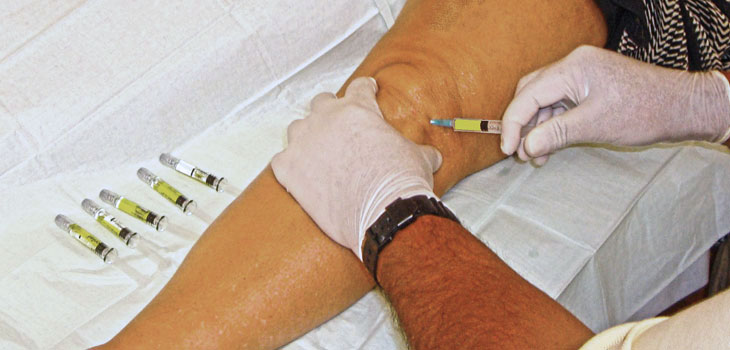 Hyaluronic Acid Injections Delay TKA
