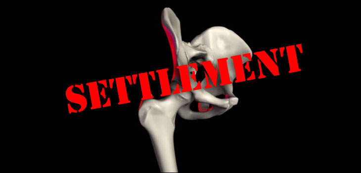 It’s Official – DePuy Settles Hip Lawsuits for $2.5 Billion