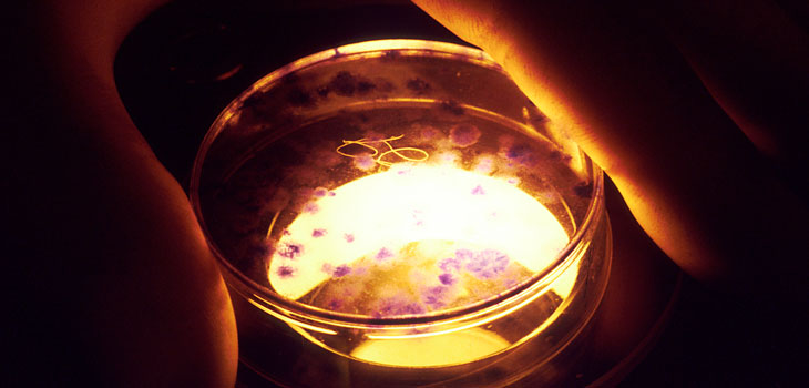 One Step Closer to Artificial Cartilage