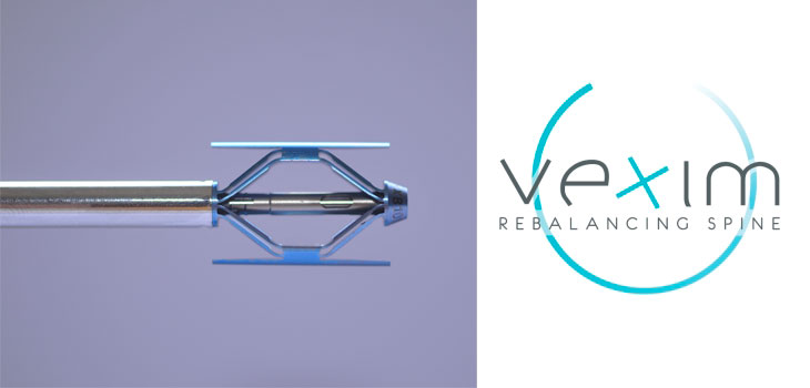 VEXIM Launches Interface for SpineJack