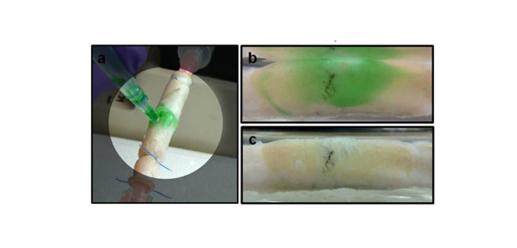 Hydrogel Seals Wounds Then Releases
