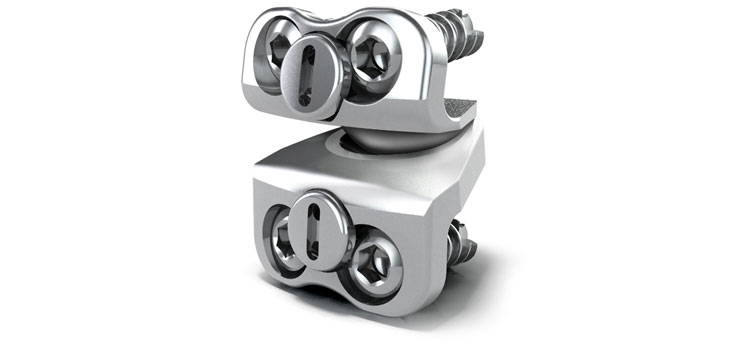 Medtronic’s Prestige Cervical Disc Bests Fusion