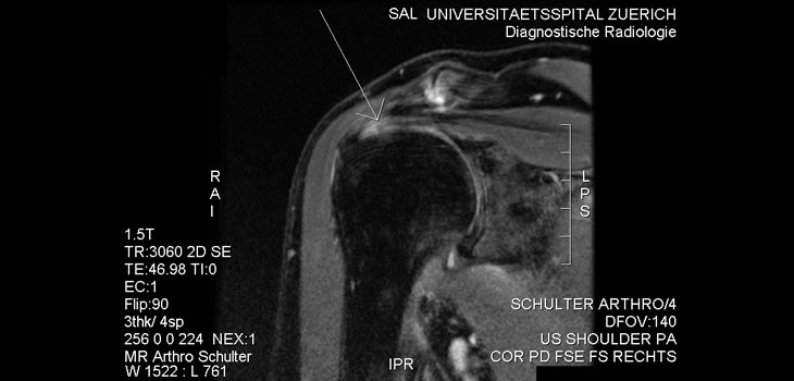 Auxilium Doses First Patient in CCH/Frozen Shoulder Study