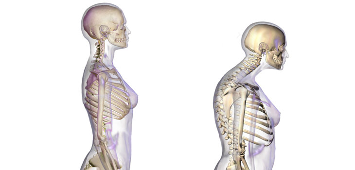 Denosumab Trumps Zoledronic Acid for Spine BMD
