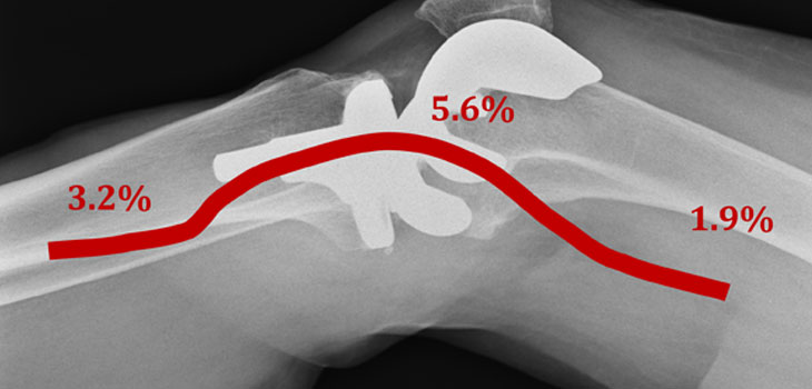 New Report: Global TKA Growth Rate Down to 1.9%