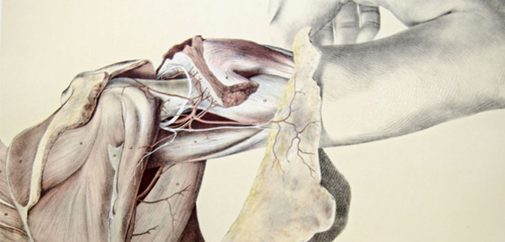 Mayo Study: Shoulder Replacement Helps RA Patients