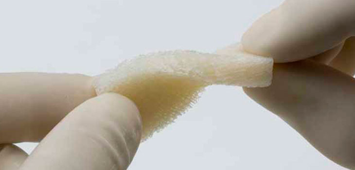 New DePuy Synthes Matrix for Fusion