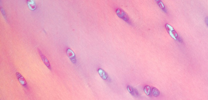 Stem Cell Cartilage Rejuvenation Inches Closer