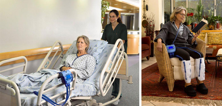 New JBJS Study: Compression = Thinners in Preventing DVT’s