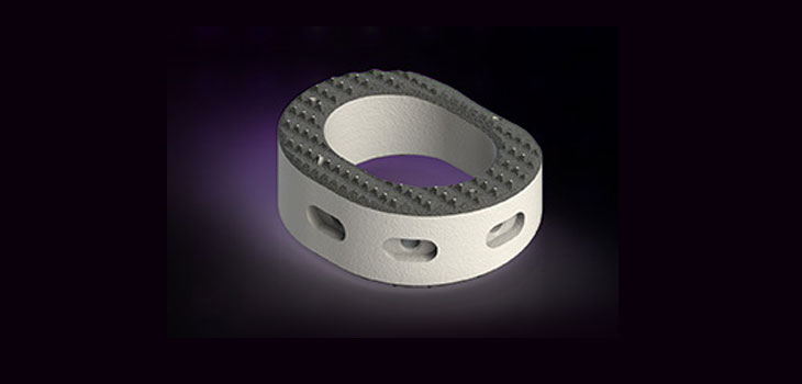 FDA Clears Aurora Spine’s TiNano