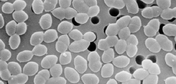 The END of Implant Associated Bone Infections?
