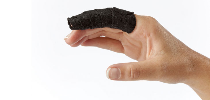 Moldable Thermoplastic Finger Splint
