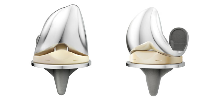 DePuy Synthes Adds Features to Attune Knee at AAOS