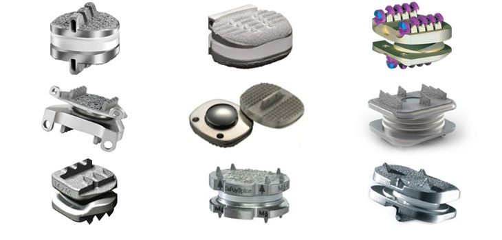 Remember Artificial Disc Replacement?