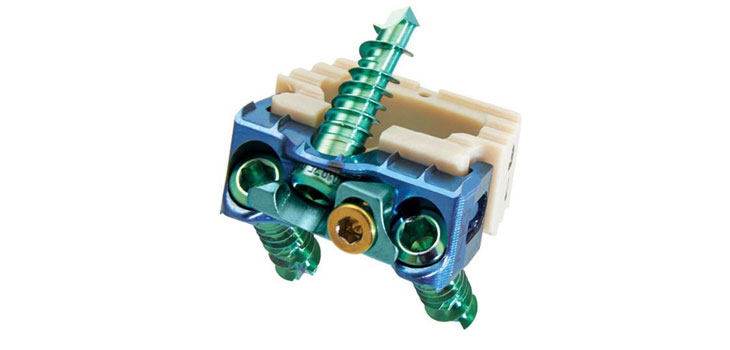 Zimmer Spine Launches No-Profile Cervical Device