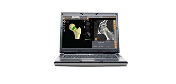 Smith & Nephew Launches DYONICS PLAN