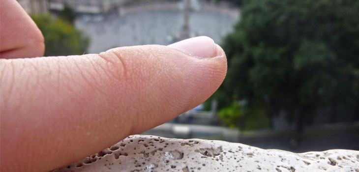 Finger Length A Predictor of OA?