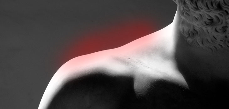 Shoulder Repair Tricky Second Time Around