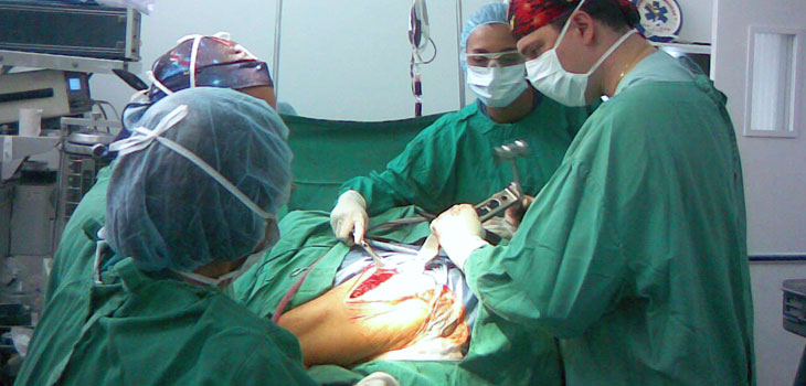 ACL Surgery Can Lead to Osteoarthritis