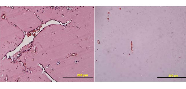 RA: Molecules Involved in Angiogenesis Identified