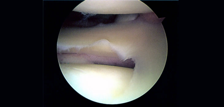 Study Questions Arthroscopic Knee Surgery