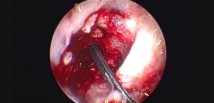 New Program Makes Better Arthroscopists // Lateral Meniscus Guide 30-50% Off?! Study Must Read // and MORE!!
