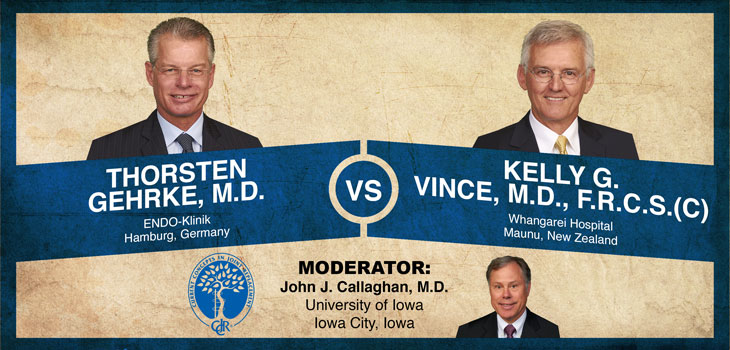 Gehrke, Vince Debate Cemented Stems in Revision TKA