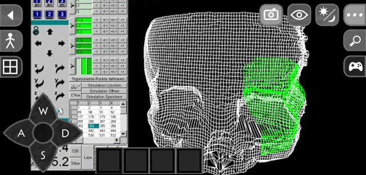 Award Winning 3D System Improves Surgical Precision // PT Doesn’t Improve Pain, Function in OA// and More!