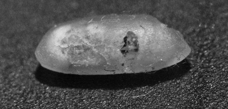 Pacemaker Size of Rice Grain