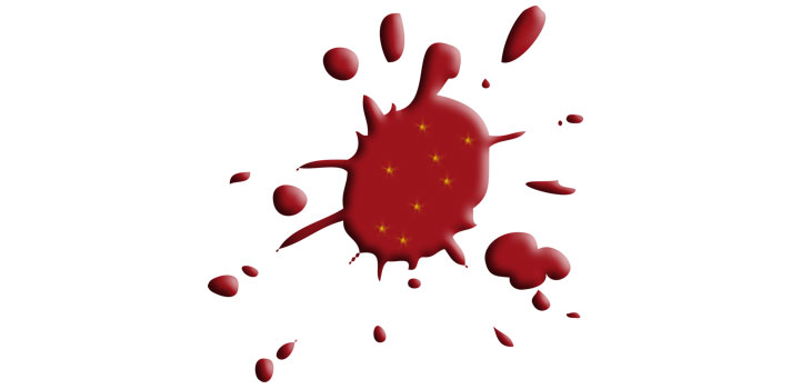 Biomarkers May Predict Osteoarthritis