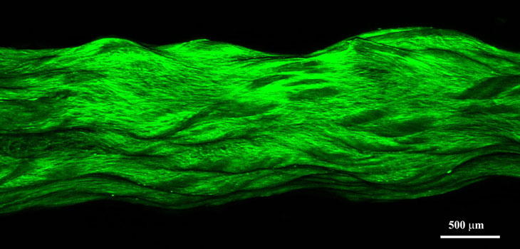 $1.7 Million to Case Western Engineer for Growing Tissue