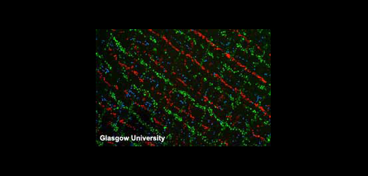 Astonishing Sonic Tweezers Manipulate Cells Into Cartilage