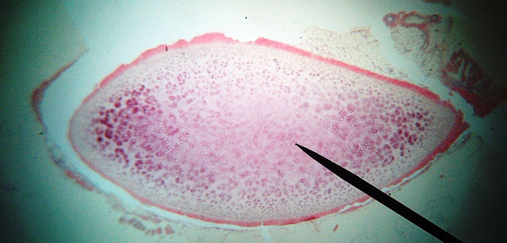 Regenerative Medicine Market on Growth Spurt