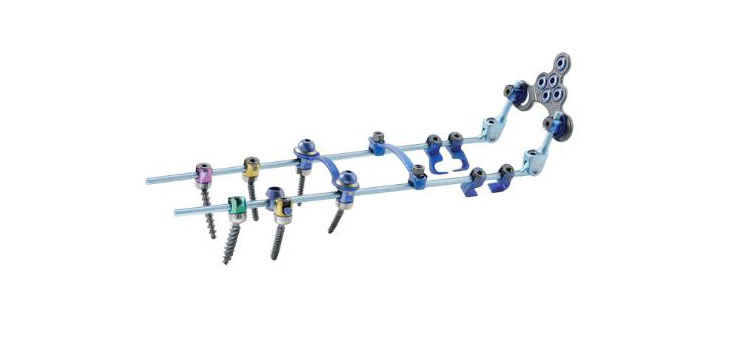 Zimmer Spine’s OCT Fixation System Promises to Change “Perspective”