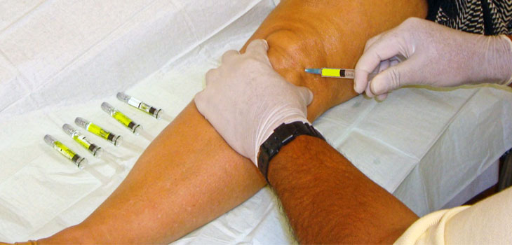 Finding the Replacement for HA Injections in the Knee